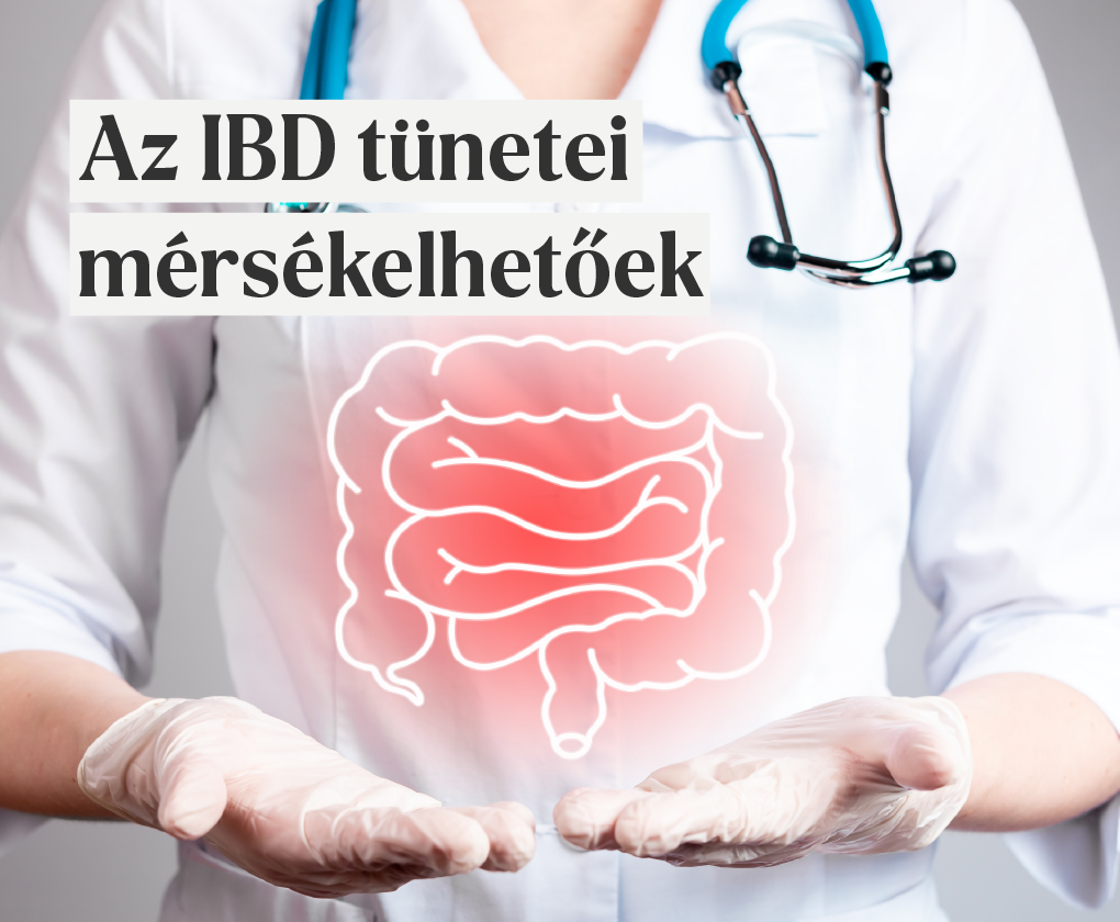 IBD: Alapvető tudnivalók a gyulladásos bélbetegségekről